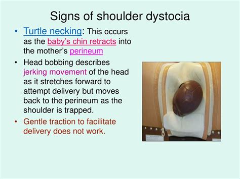 turtle sign shoulder dystocia.